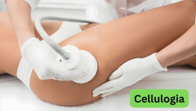 Cellulogia