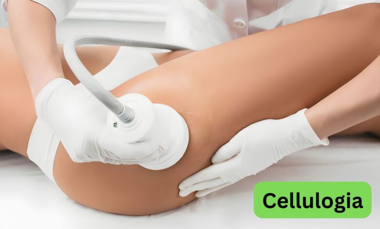 Cellulogia